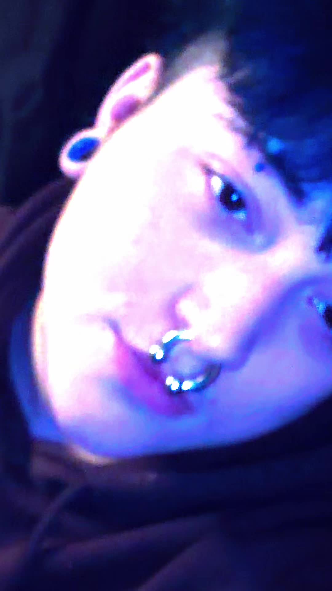 @🦷tooth🦷