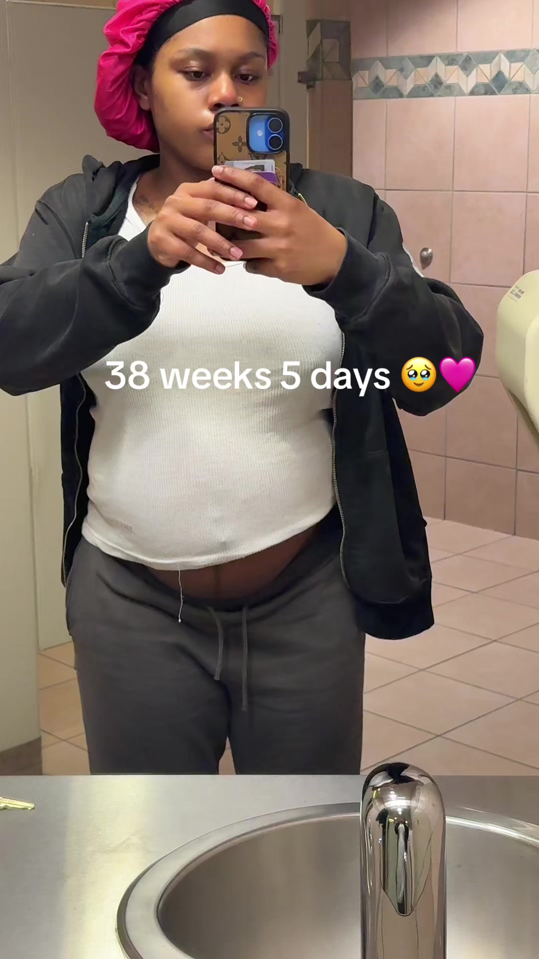 @🙈🙈