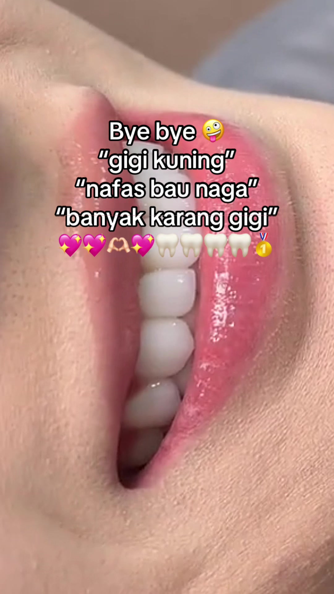 @Gigi Putih Berkilau🦷✨