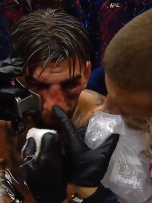 @UFC