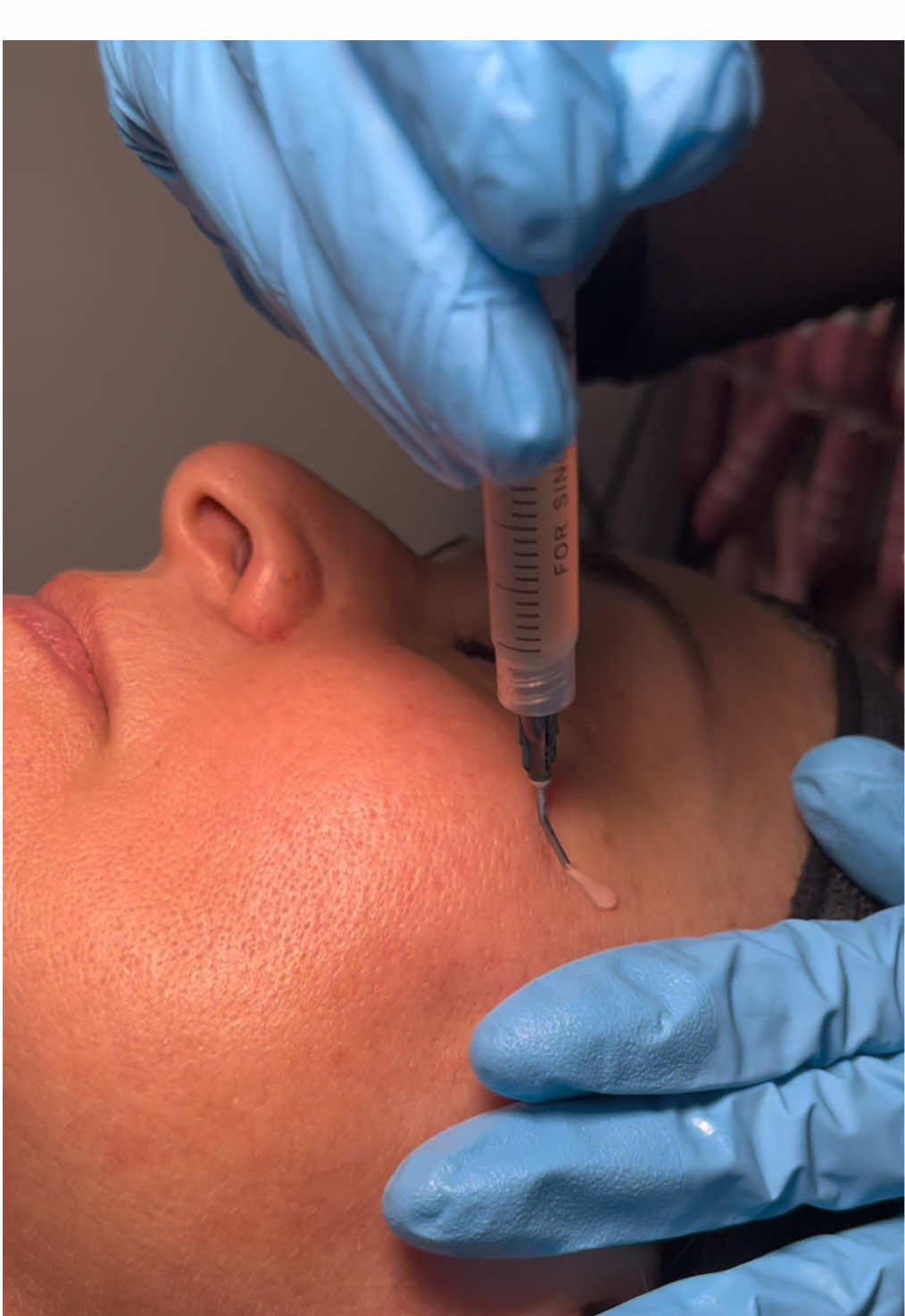 @Opal MD Aesthetics