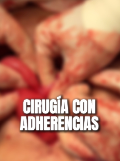 @Dr Julio Pérez