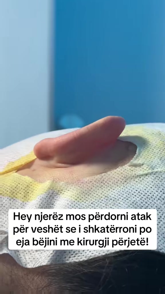 @rinoplasticatirana