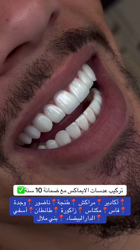 @brightsmileee1