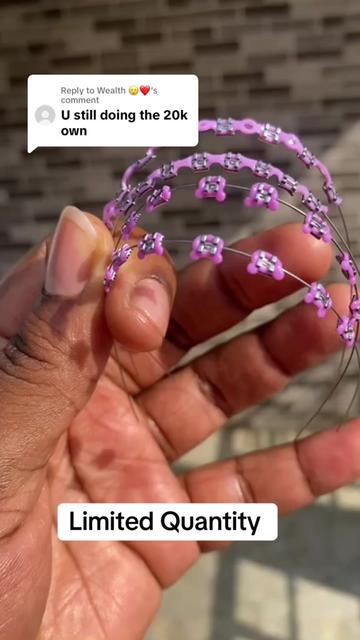 @Braces.bymavi|Smile Aesthetics
