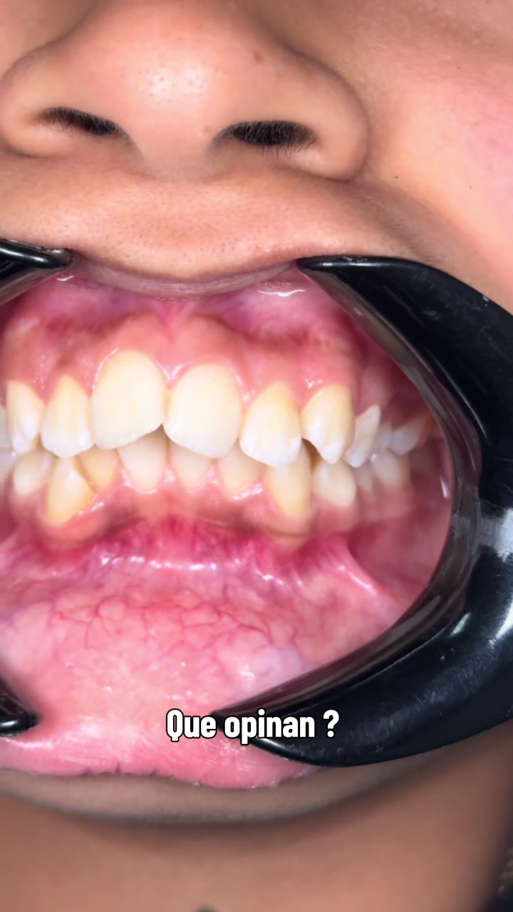 @Dr. Juan Perez | Ortodoncista