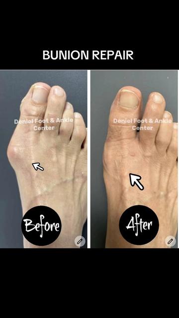 @Deniel Foot and Ankle Center