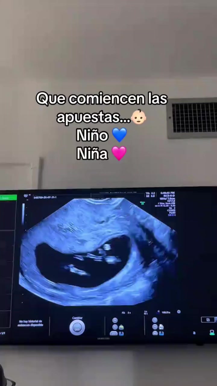 @Naye S&aacute;nchez
