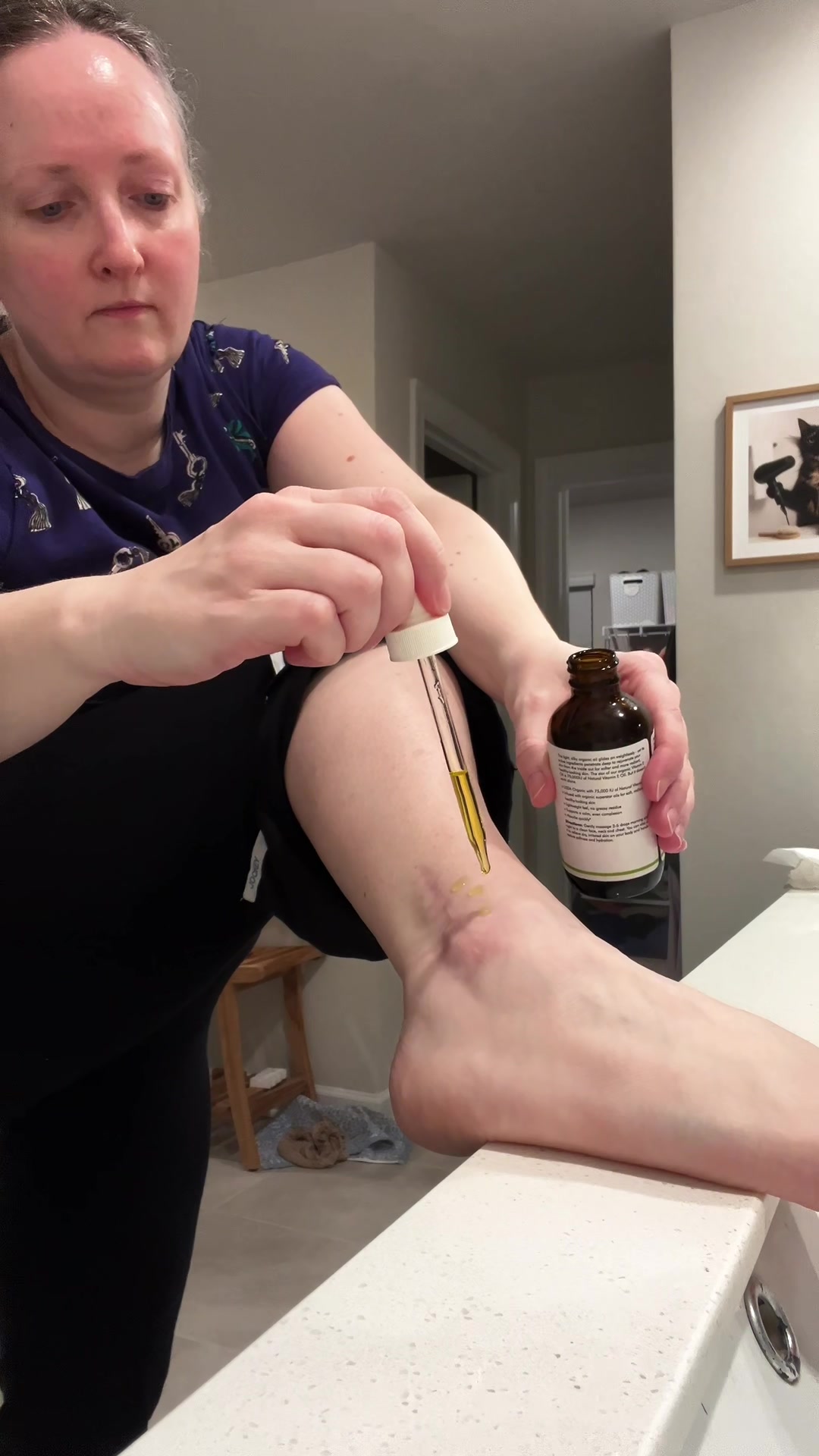 @MelanomaMom