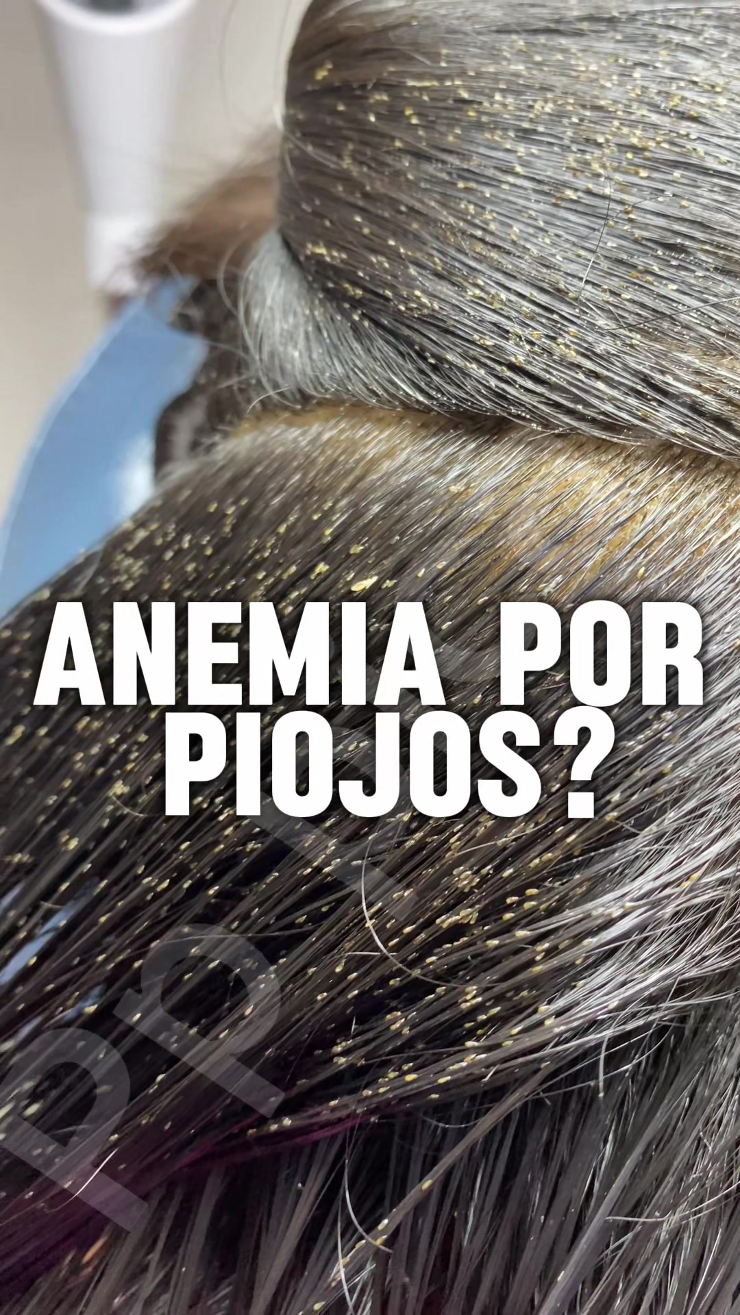 @Pppicas