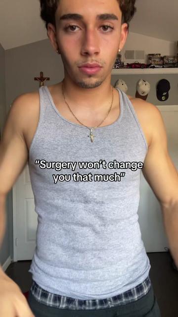@Jorgito