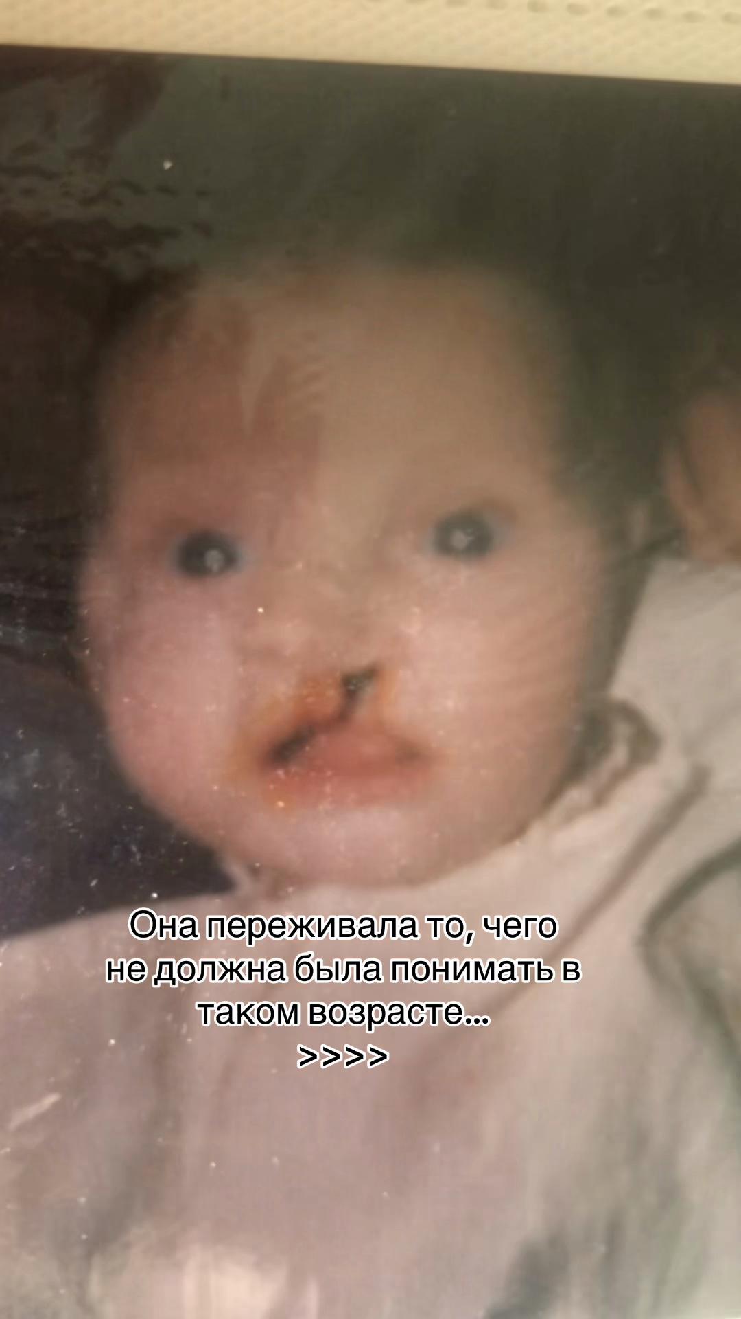 @Нэтти с необычным лицом ~