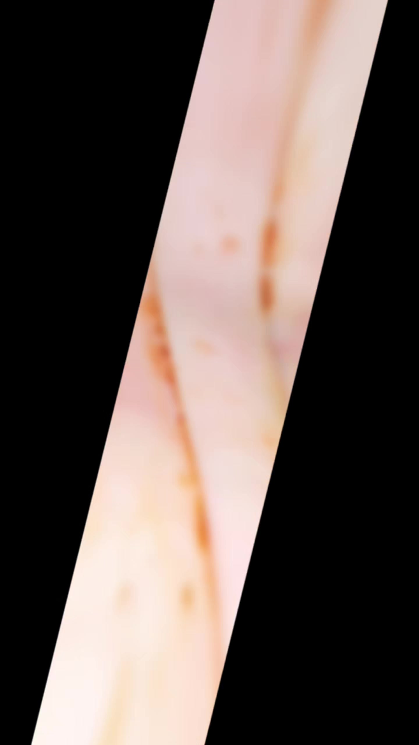 @mvklokan