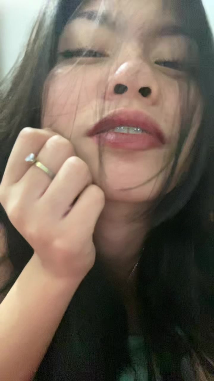@777