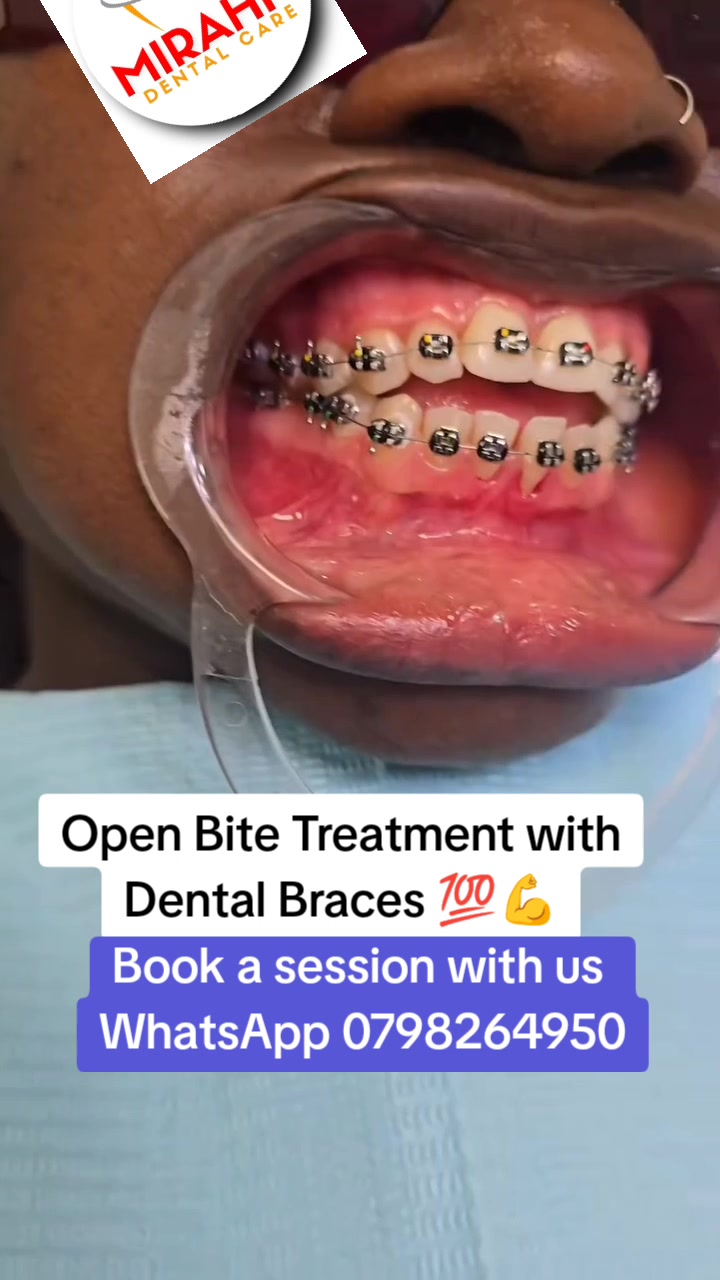 @MIRAHN DENTAL CARE