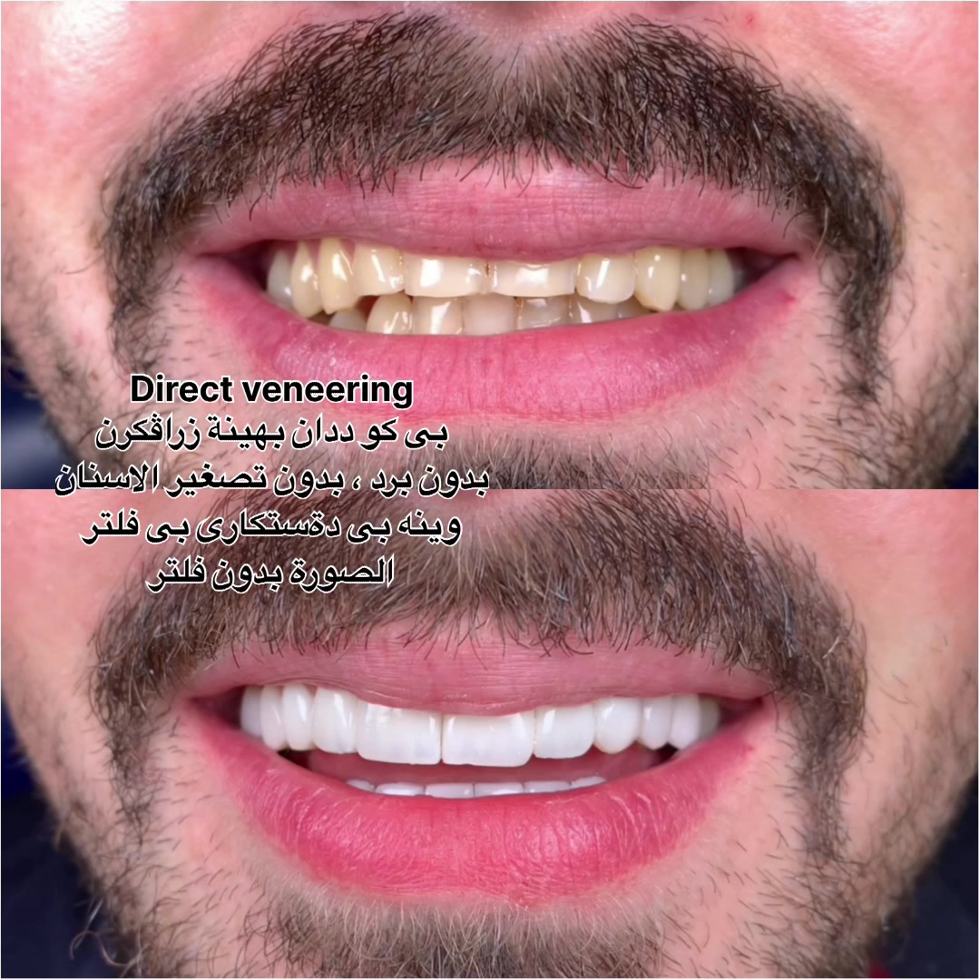 @Dr.Mohammed.Bandi