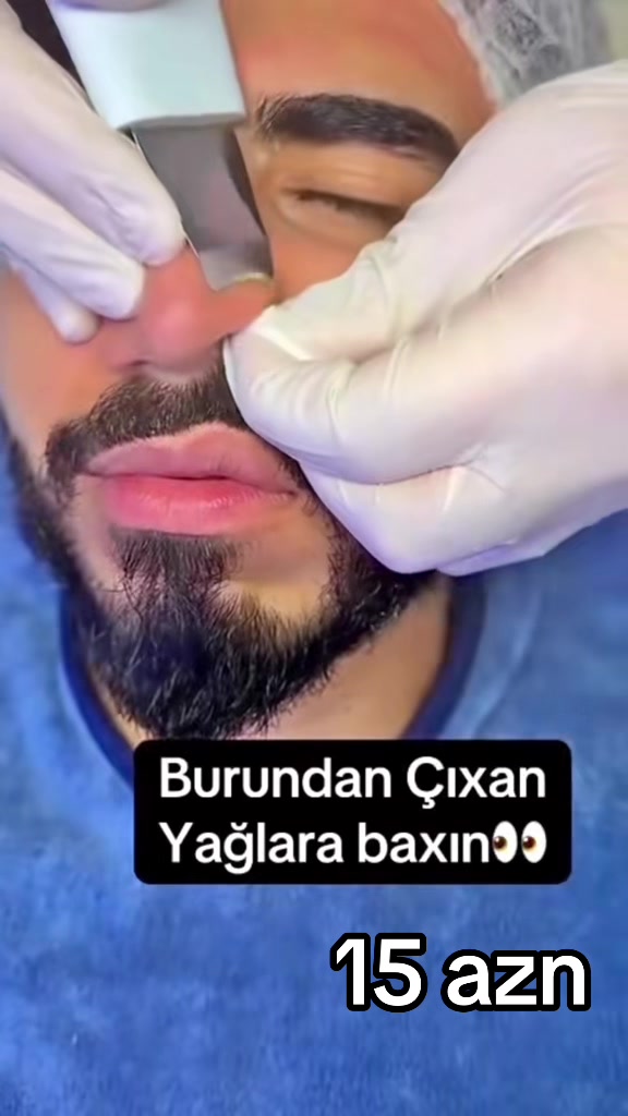 @Tattoo Extra