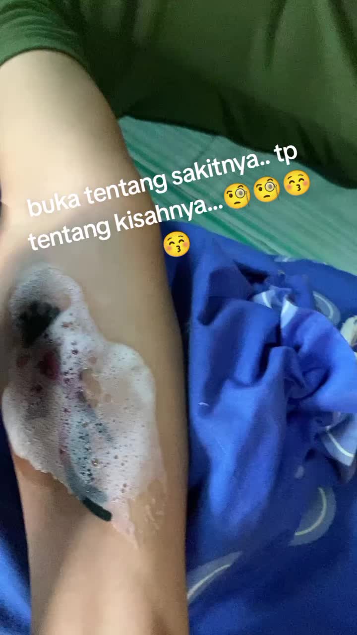 @Manis69