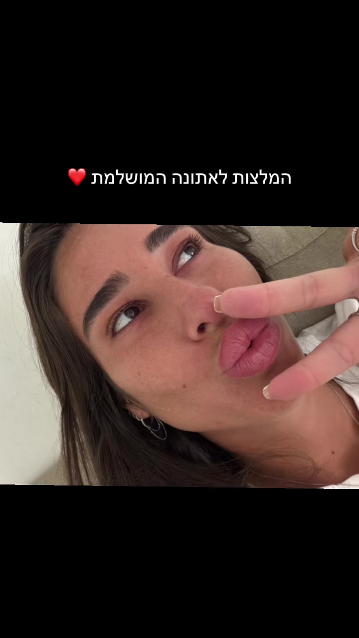 @Sapir Dino