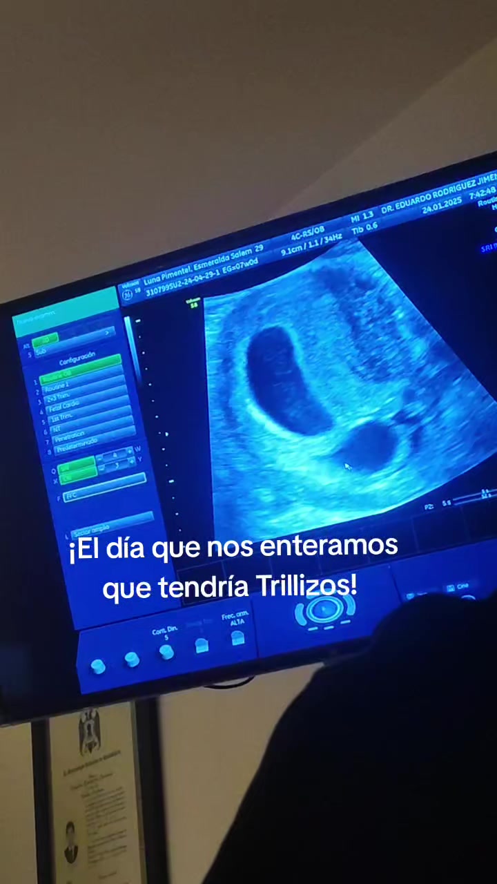 @esme y sus trilliz