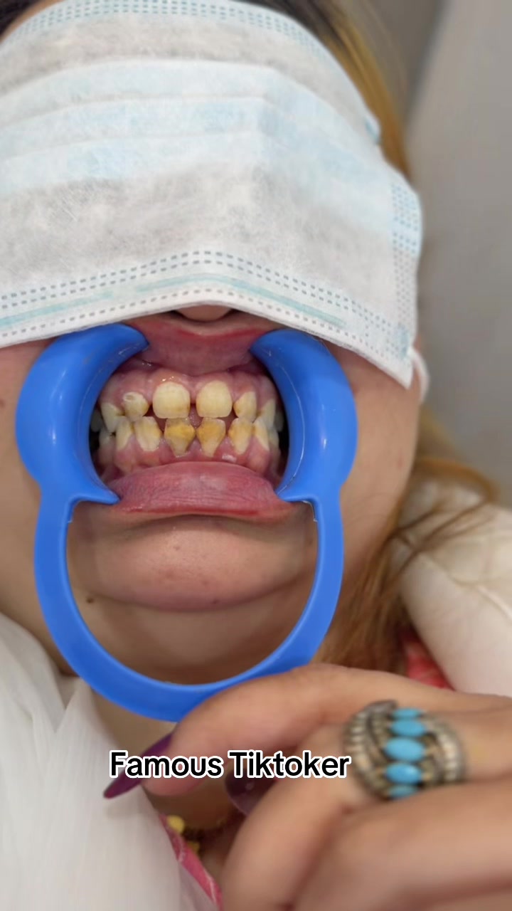 @Dr__Anmoll🦋🦷