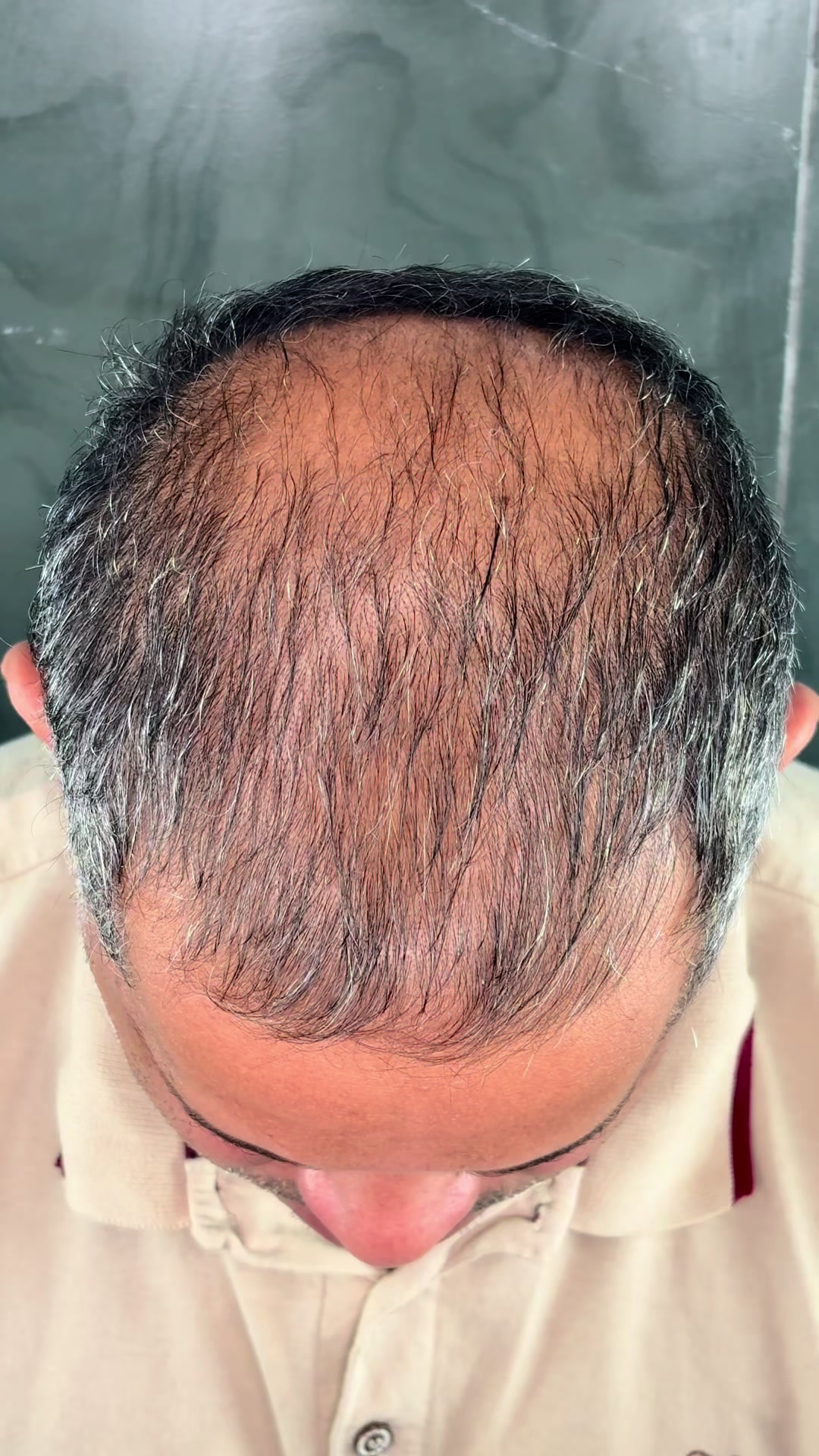 @Valesca Abi Ackel Scalp