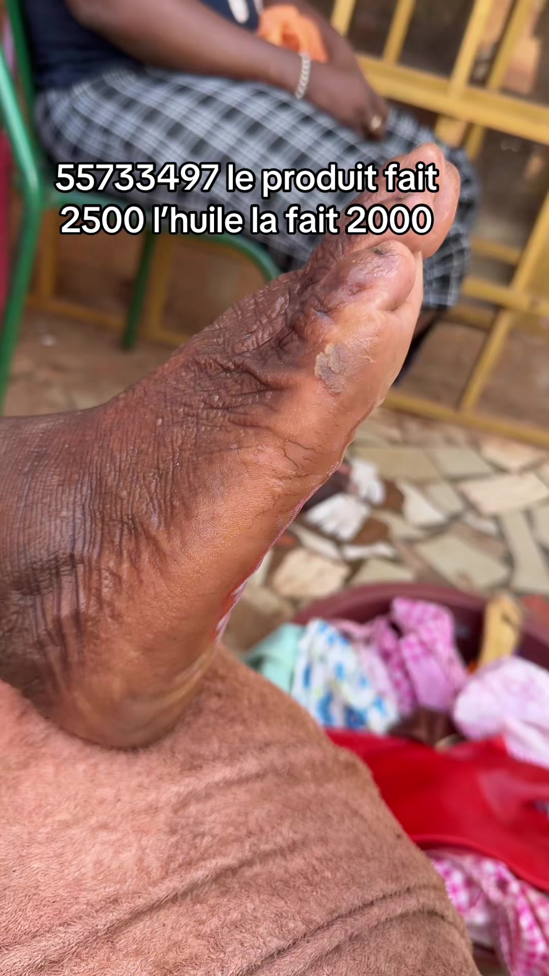 @๐๐ชï๐ฌ๐ฑ๐ธ๐พ๐ธ๐ธ๐ธ๐ Touré
