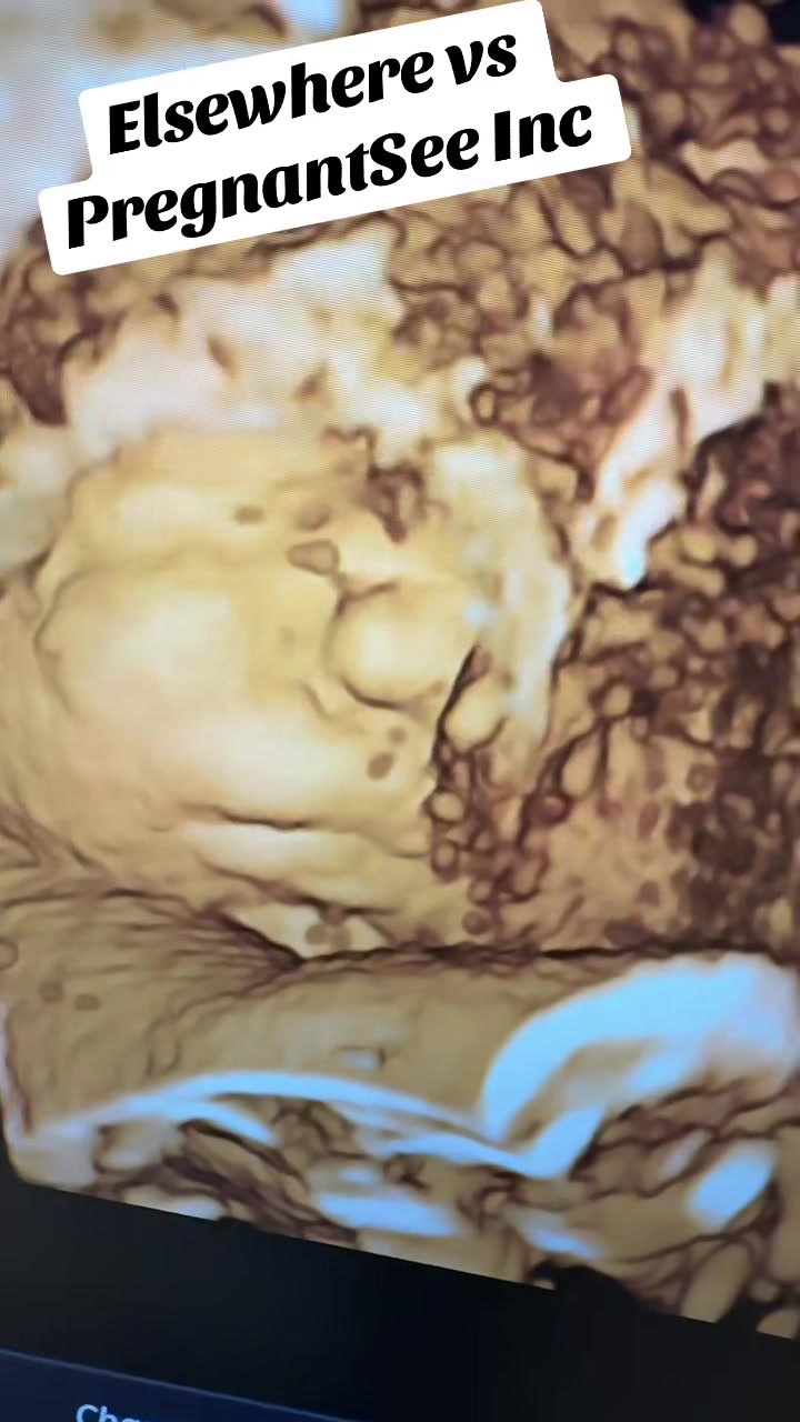 @PregnantSee Inc.