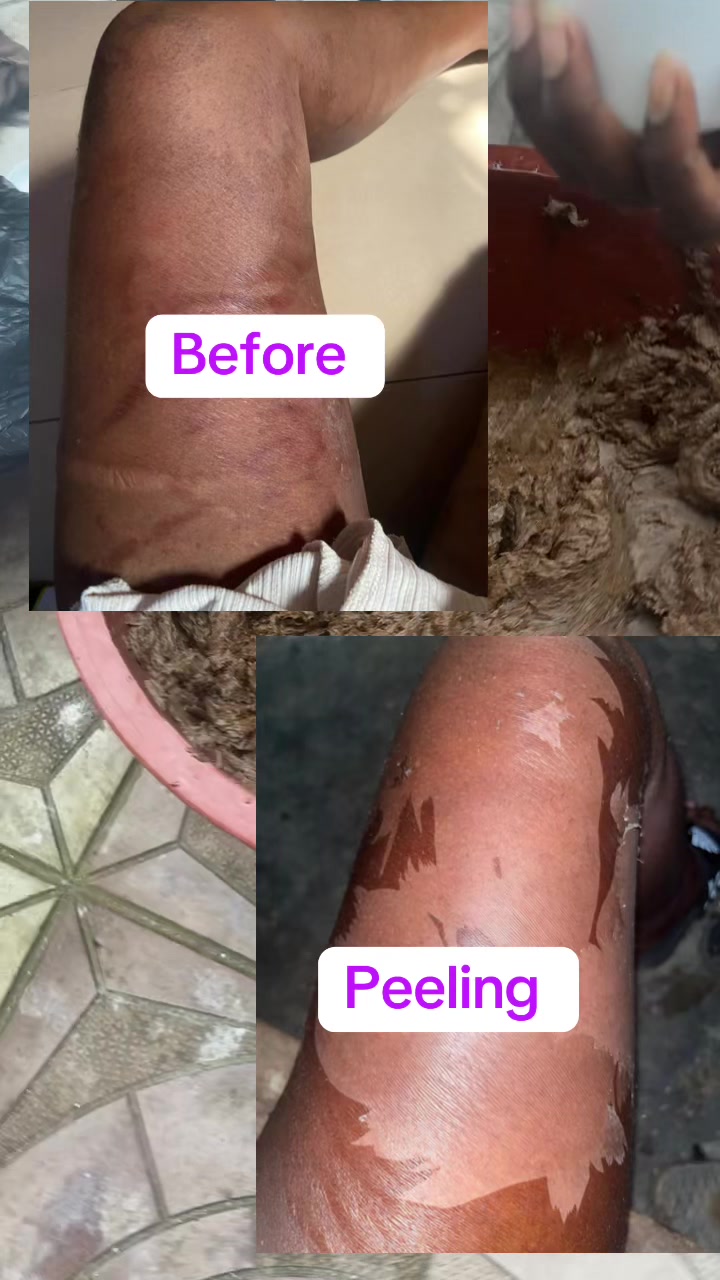 @@ Precious peeling soap