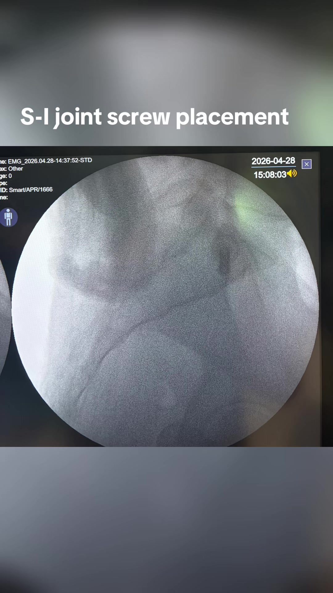 @Orthopedic_Surgeon_Arbind