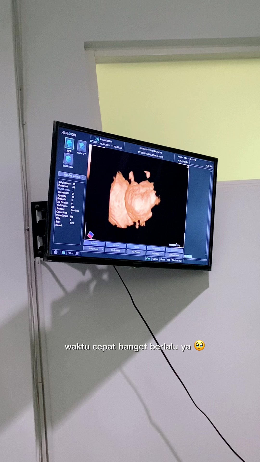 @โ๐๐ช๐๐ ๐ฃ๐๐๐หหหโกหหห