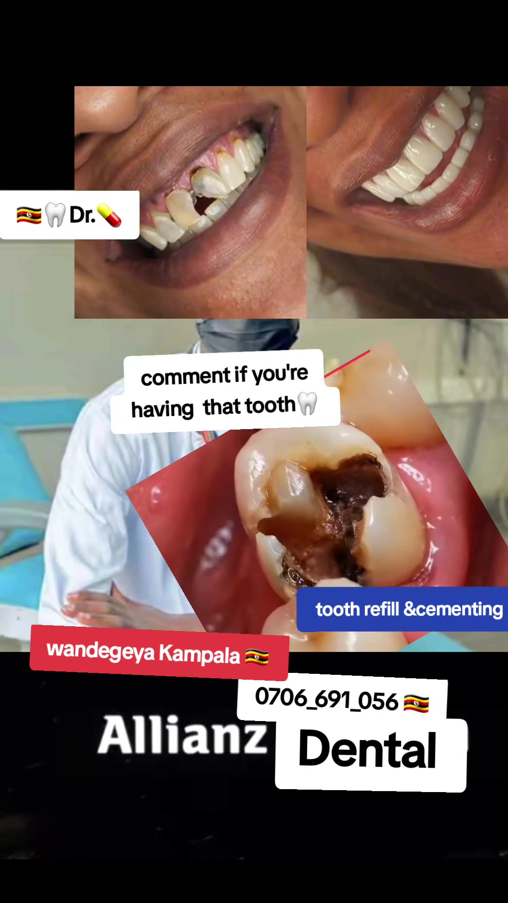 @Dental studio.🦷.Kampala