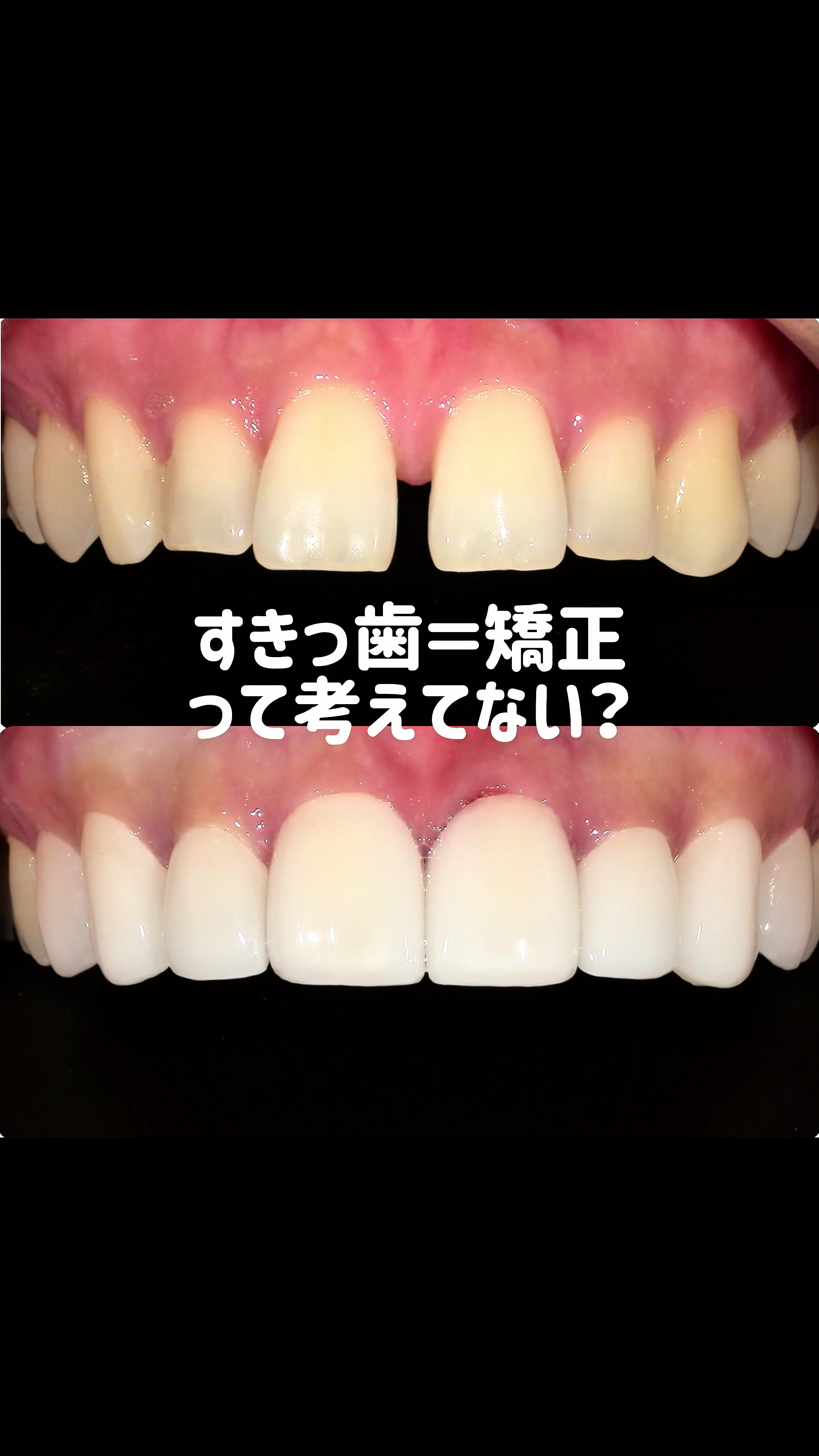 @DENTAL ALIEN