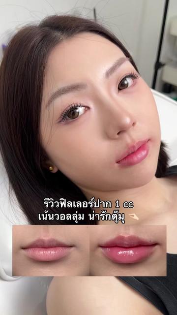 @APEXYOUNGCLINIC