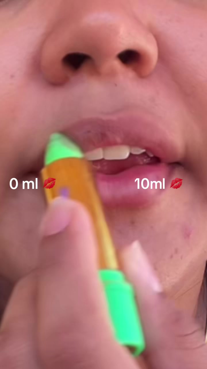 @Ray