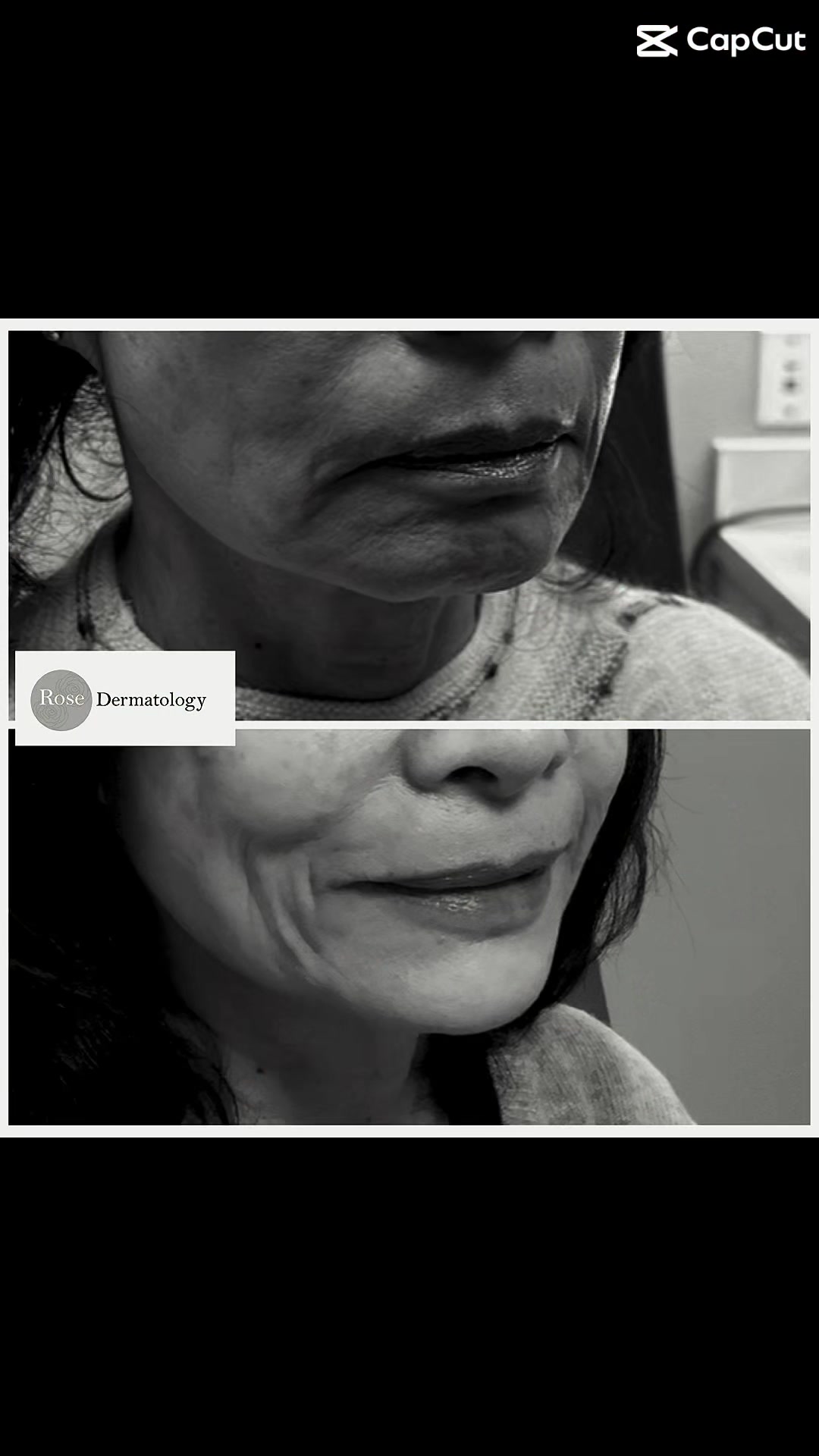 @Rosedermnyc