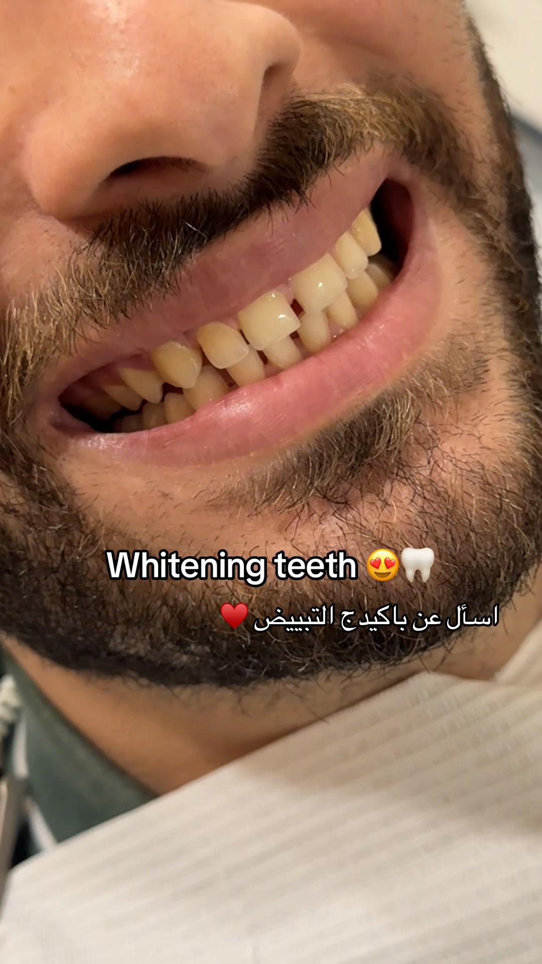 @Dr.mona.awd