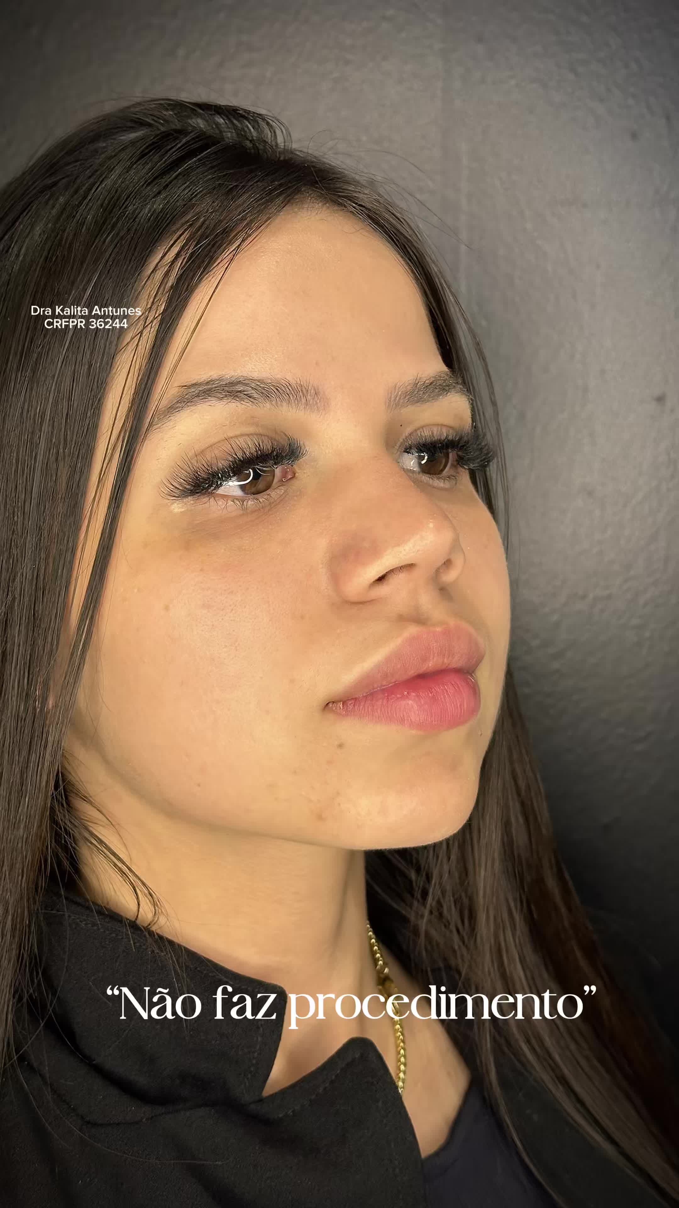 @drakalitaantunes