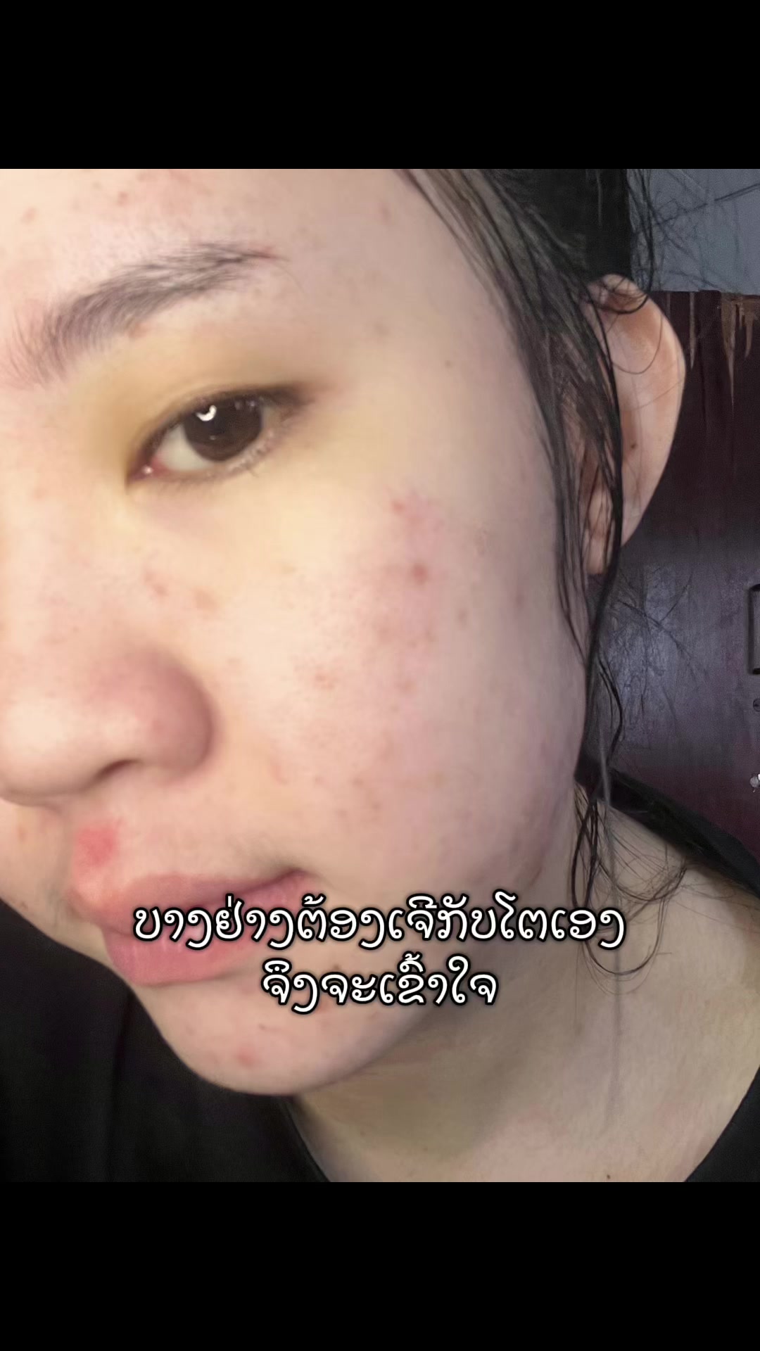 @ນ້ຳຫວານນນ😛🤍