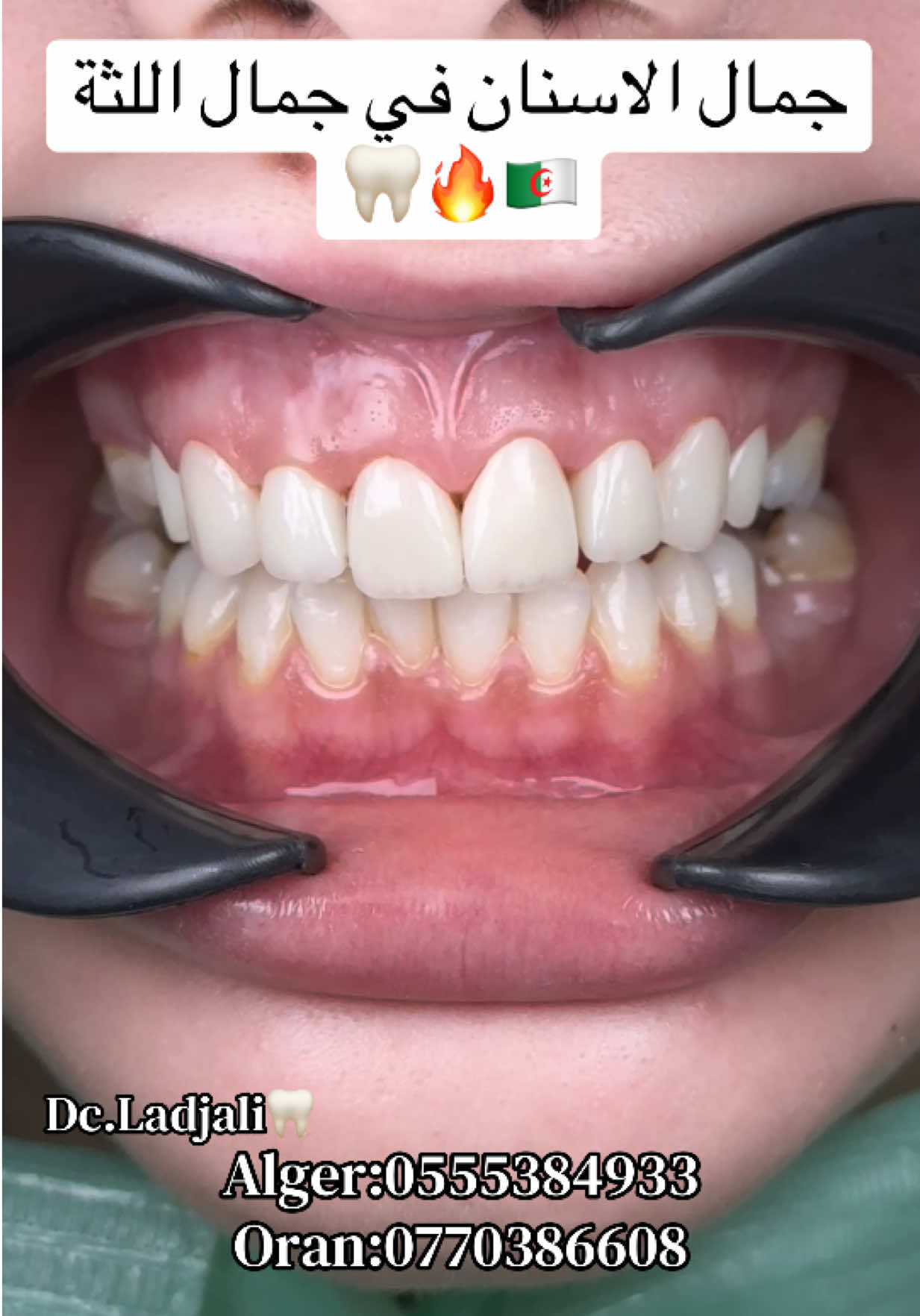 @Dr.ladjali