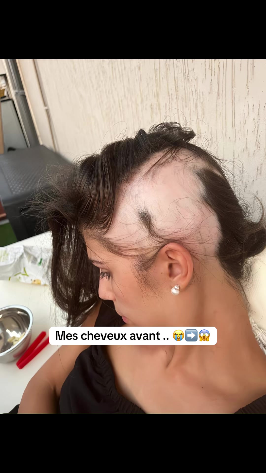 @Lux’Hair Growth FR