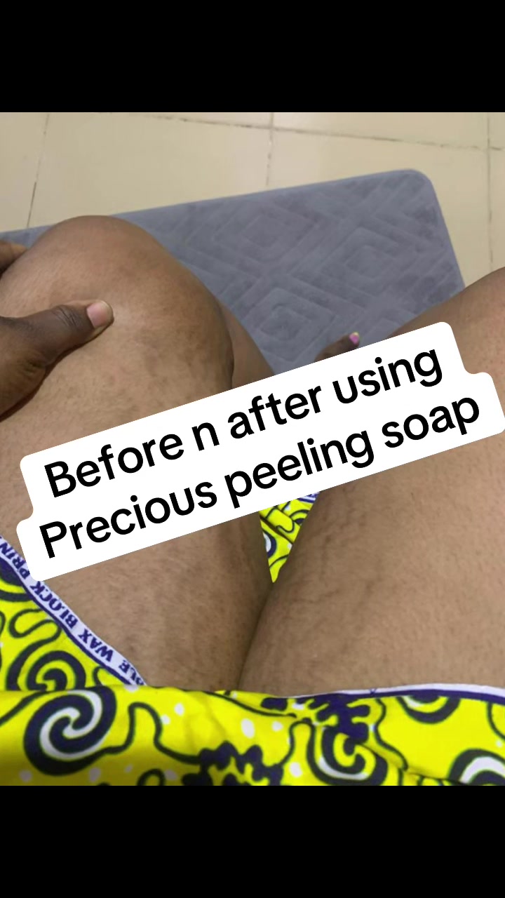 @@ Precious peeling soap