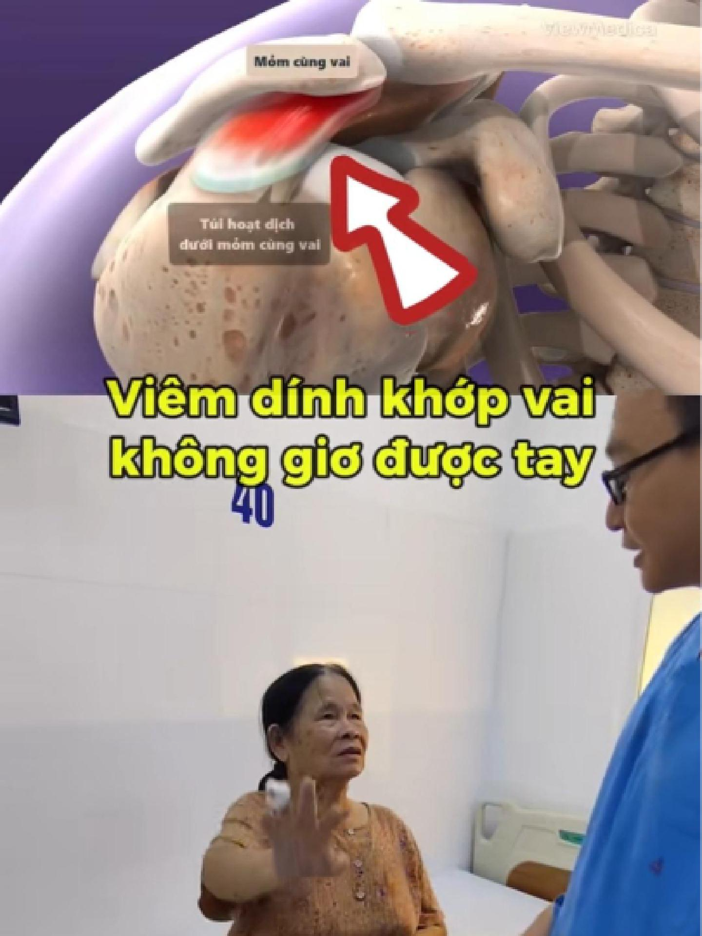 @Chuy&ecirc;n gia xương khớp