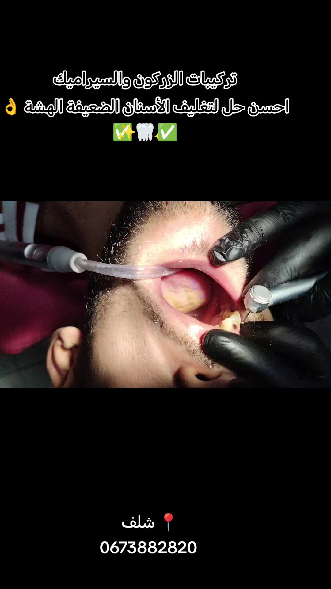 @Dr HASSOUN02 طبيبة الاسنان شلف