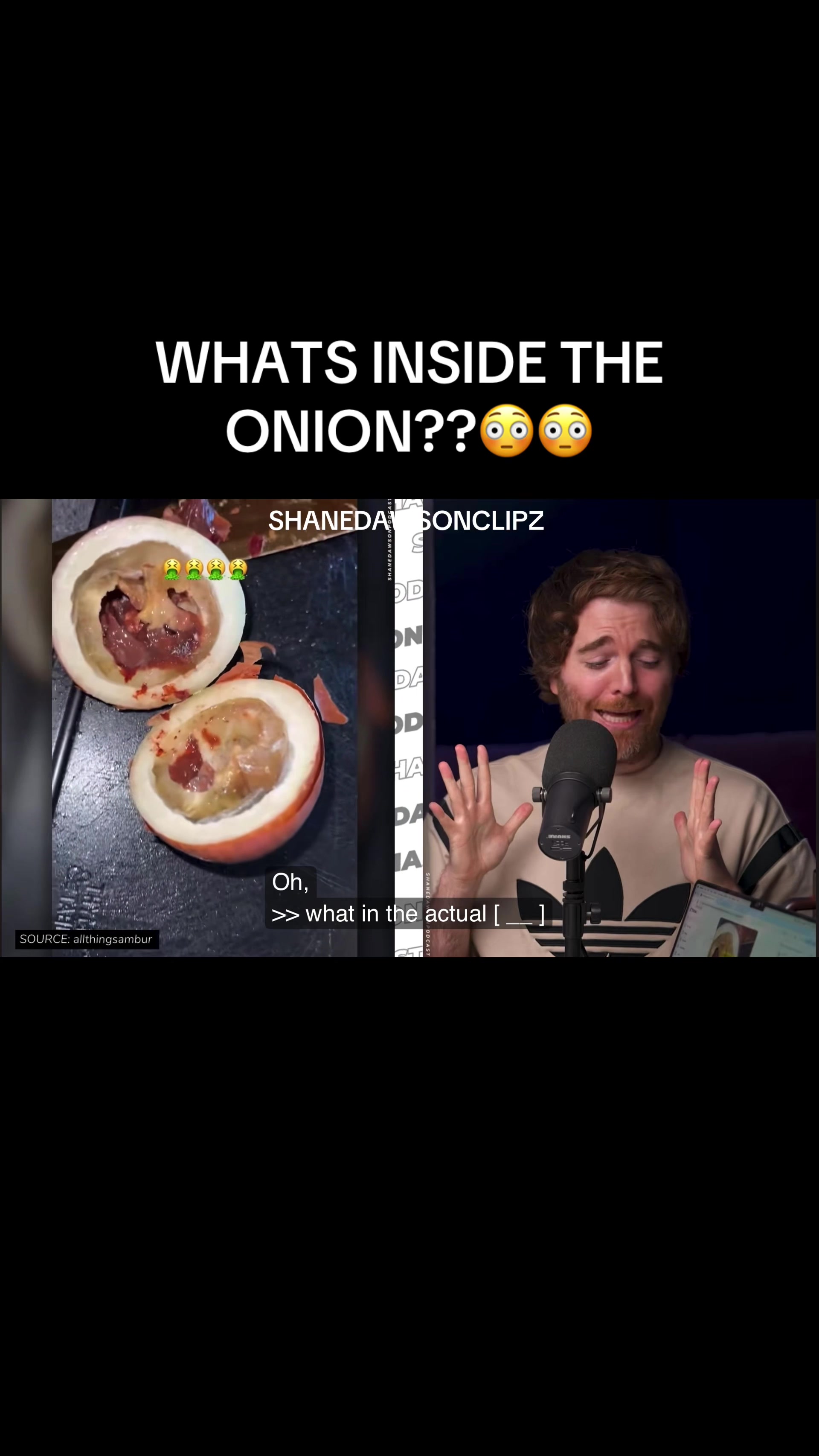 @Shanedawsonclipz