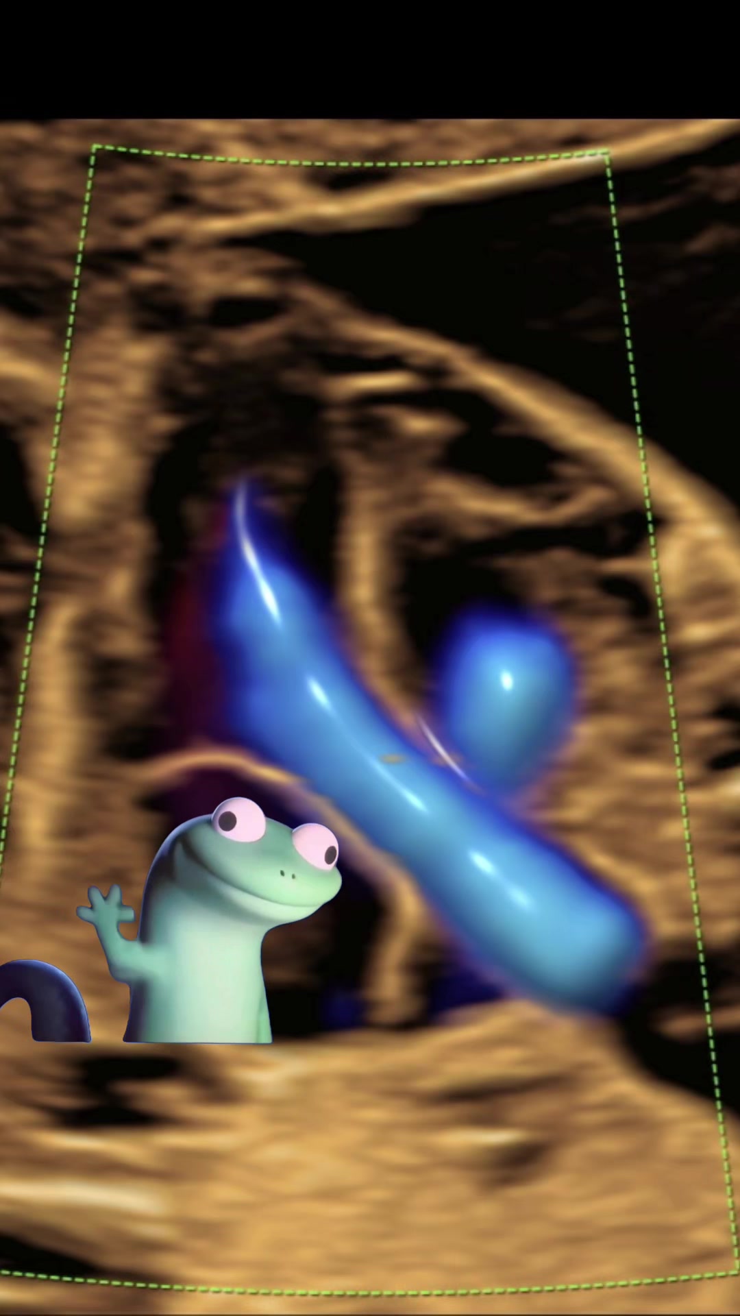 @Sonoeyes Ultrasound