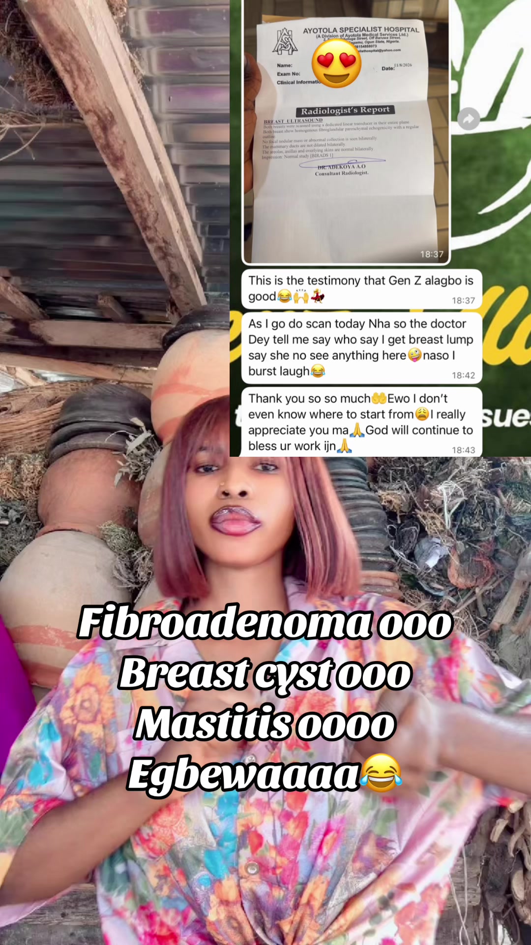 @GeNz_alagbo🐍🍯