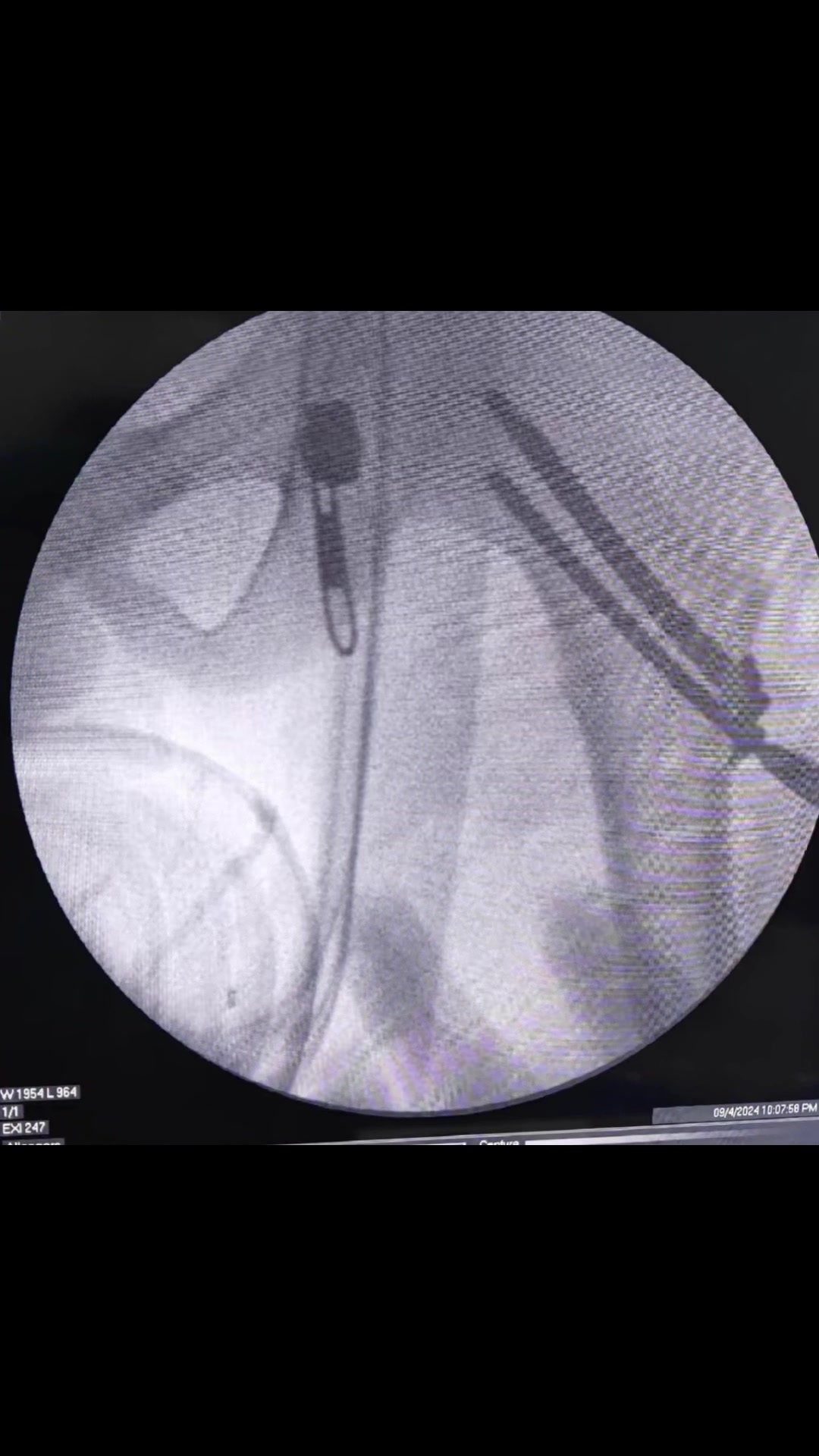 @Spine_Ortho_Surgeon_Arbind