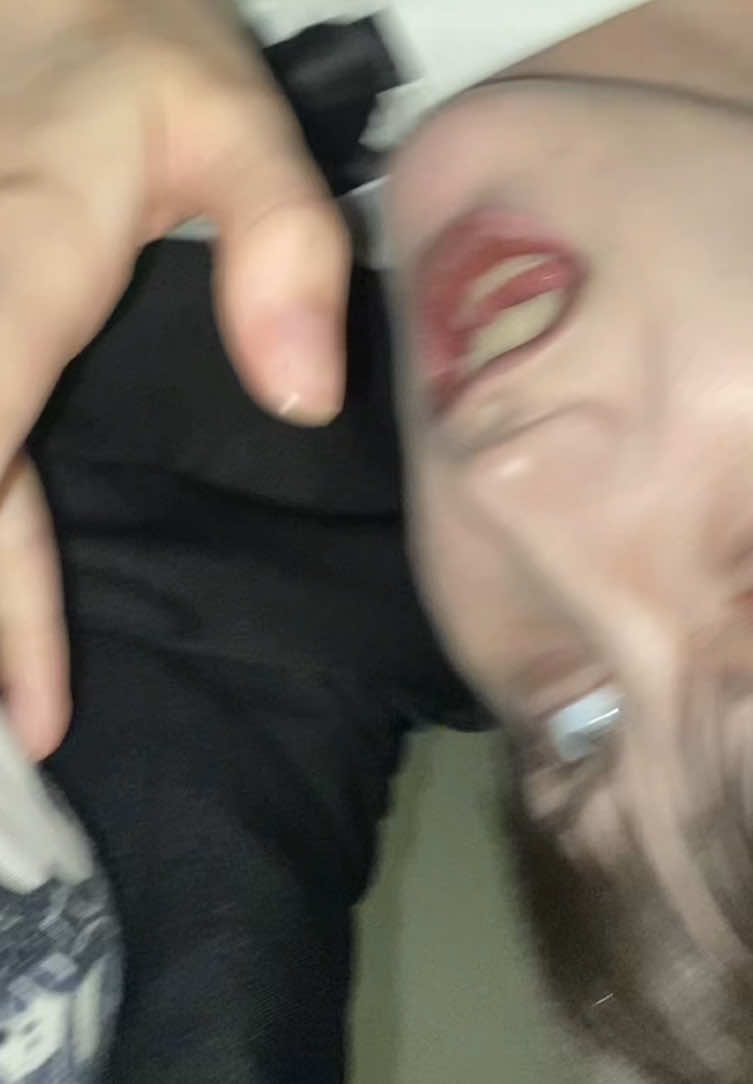 @1581