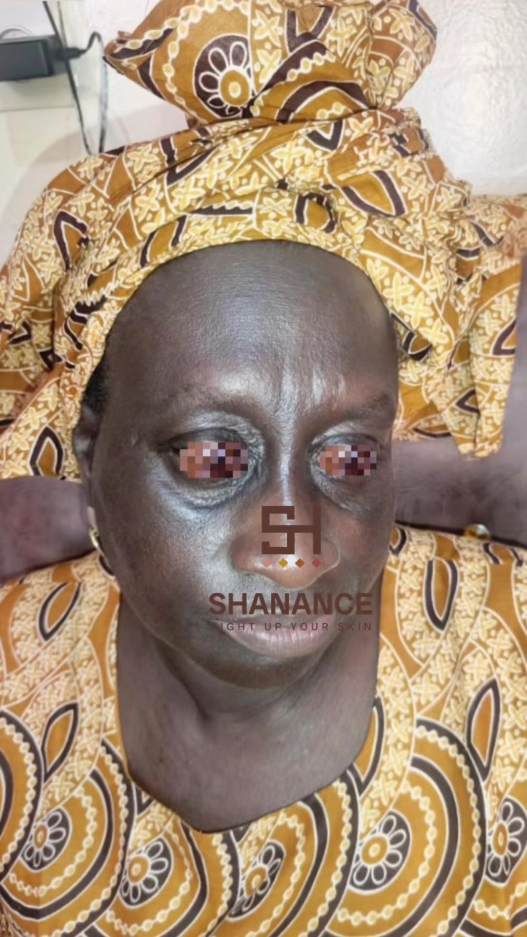 @Shana Nekob